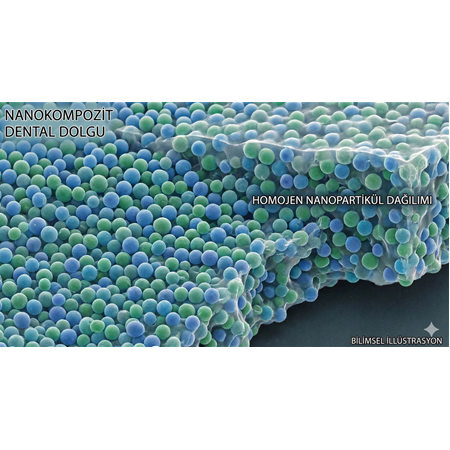 Dental Dolgularda Nanokompozit Malzemeler