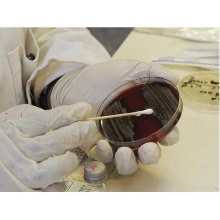 Plastik, Metal, Seramik Malzemeler için Antibakteriyel Etkinlik Tayini JIS 2801