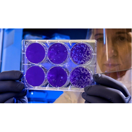 ?Covid-19 Tedavisi ve Nanoteknoloji